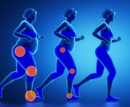 Vì sao béo phì lại gây ra các tổn thương xương khớp